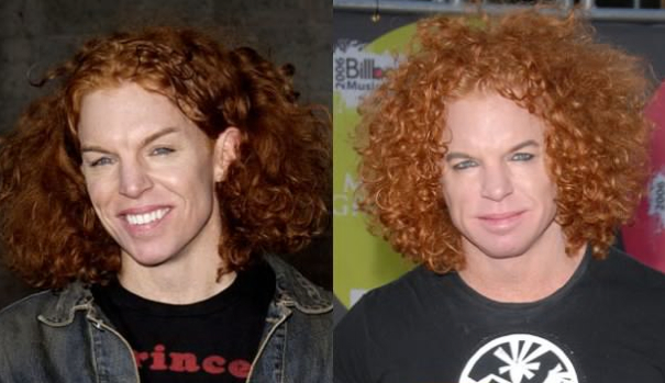 carrot top